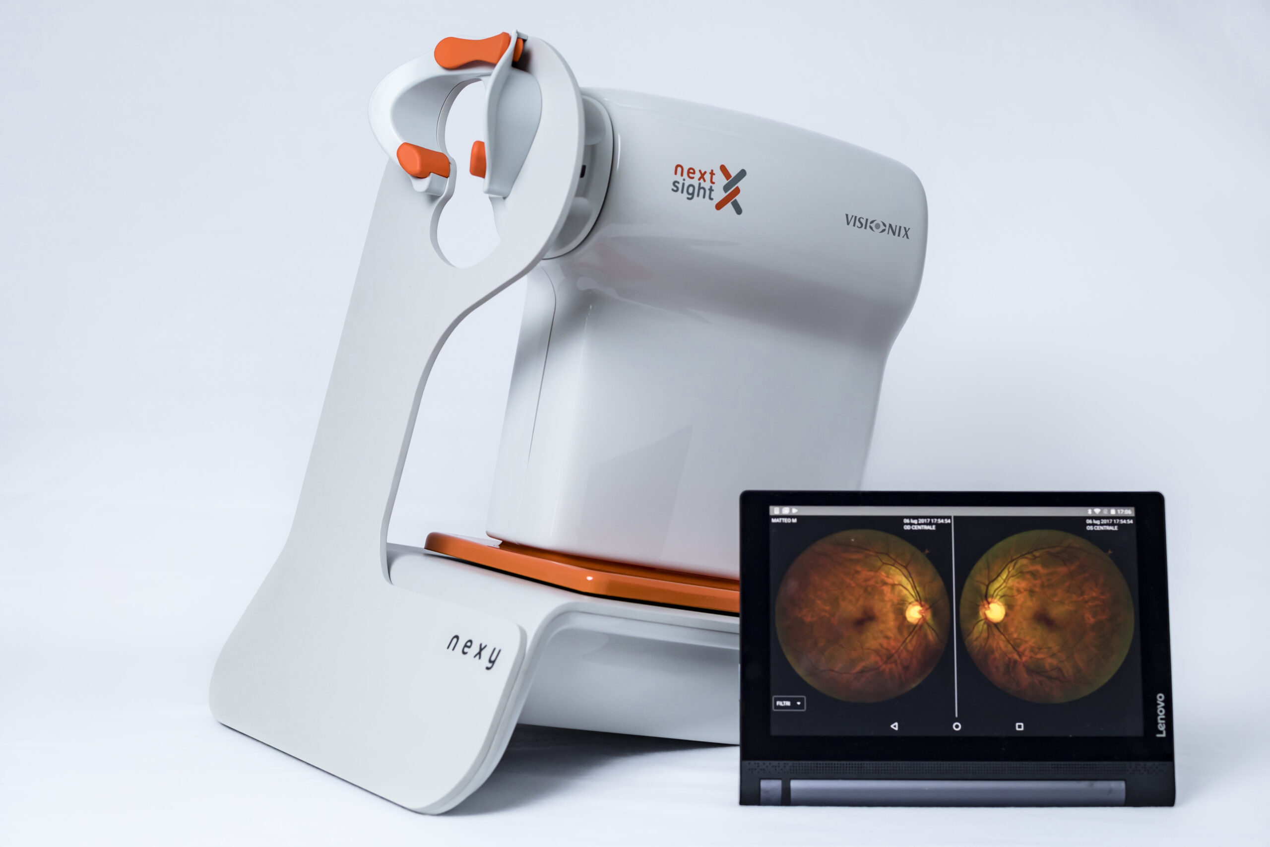 nexy-retinal-imaging-luneau-technology (4)_RVB